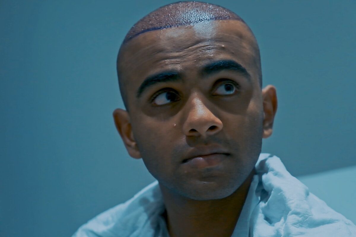 Hair Transplants: A Complete Guide to Understanding the Process and Benefits