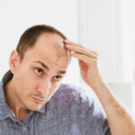 8 Common Hair Problems