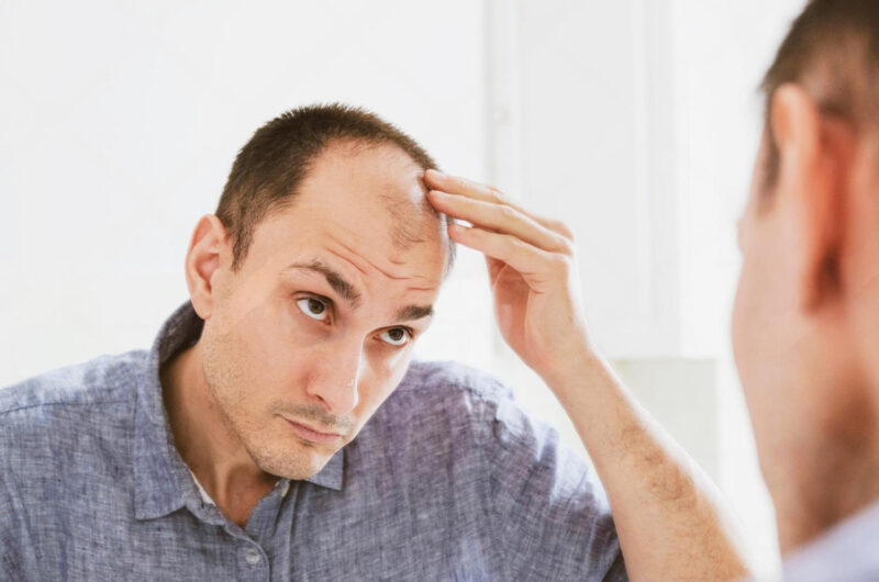 Understanding 8 Common Hair Problems: A Comprehensive Guide – How we solve them at UniquEra