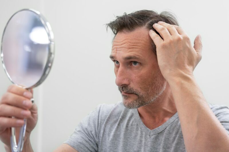 Beyond Aesthetics: The Emotional Impact of Hair Restoration Ft UniquEra