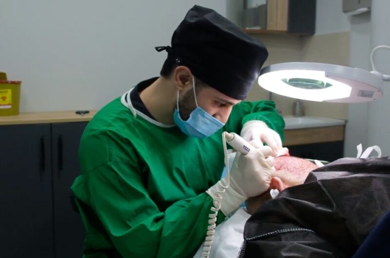 VIP Luxury Hair Transplant in Istanbul 7 Screenshot 2025 07 29 024151 e1754871675683