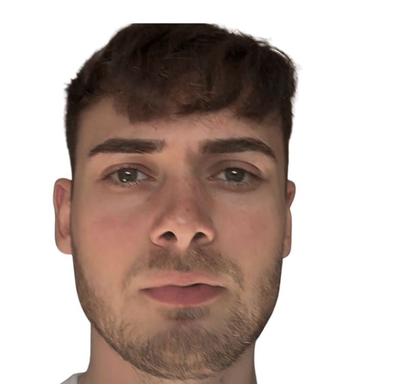 diffuse thinning after 4