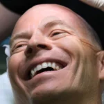 Hair Restoration