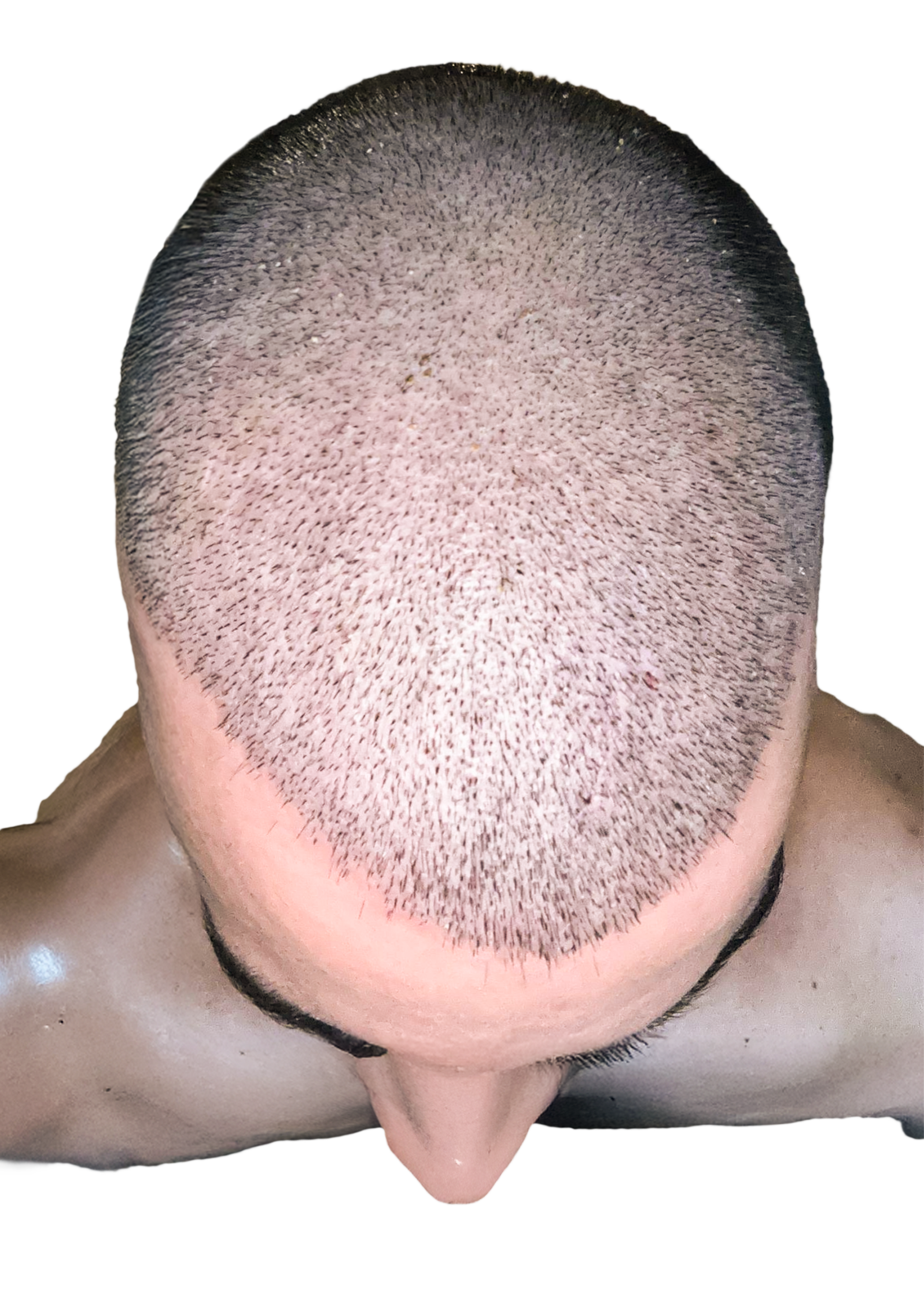 New VIP 2 3 months progress