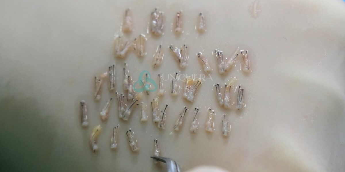 What is a Hair Follicle: Structure and Function Overview