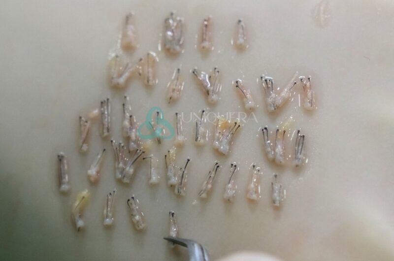 What is a Hair Follicle: Structure and Function Overview