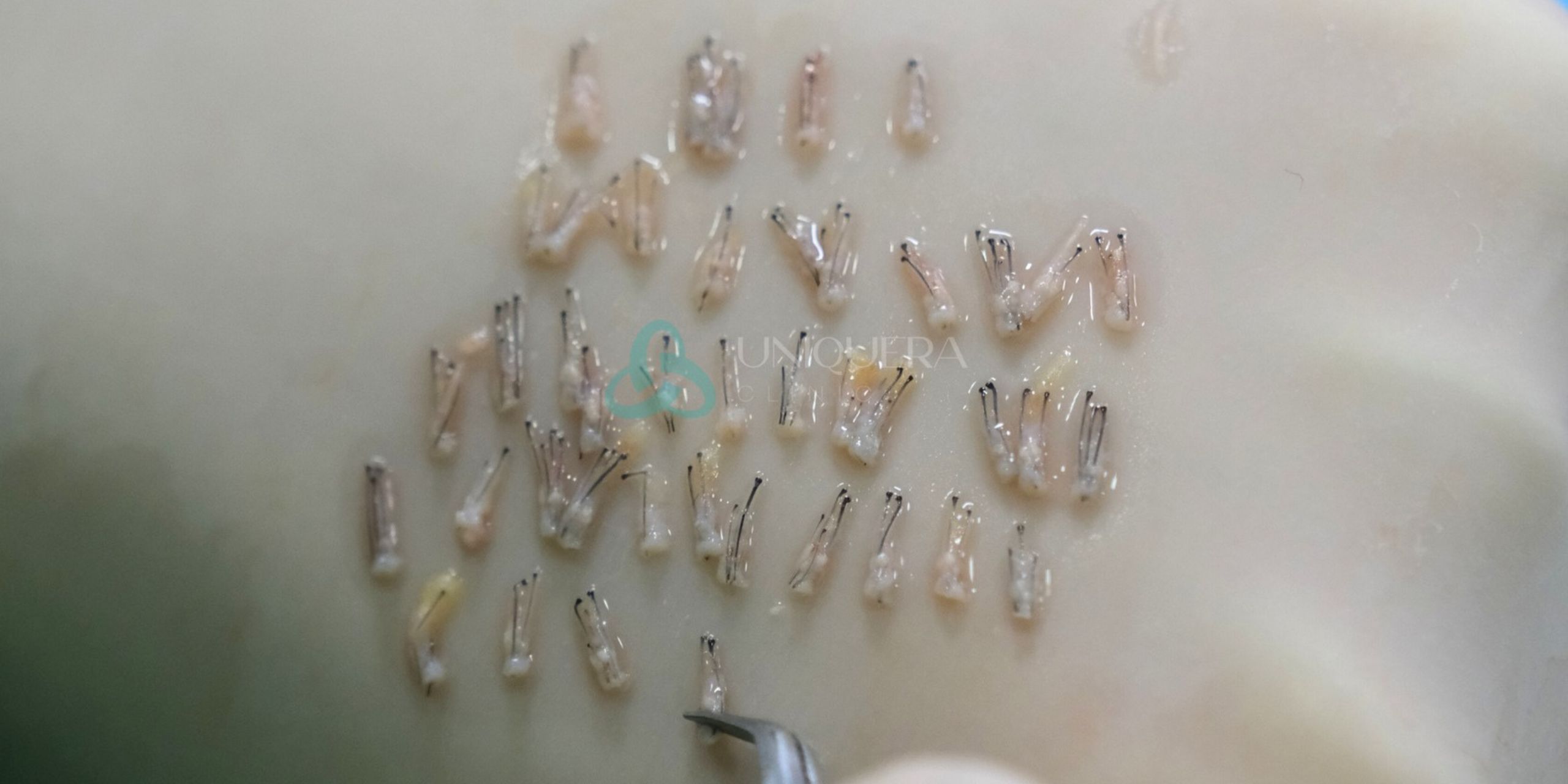 What is a Hair Follicle: Structure and Function Overview