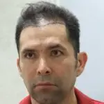 Hair Thinning - UniquEra Clinic