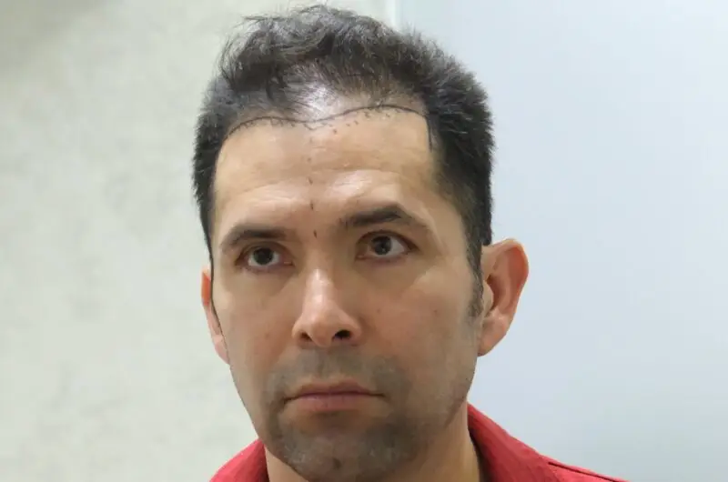 Hair Thinning: What’s Really Happening and What Solutions We Offer at UniquEra Clinic