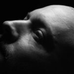 Side Effects After Hair Transplant - Uniquera.