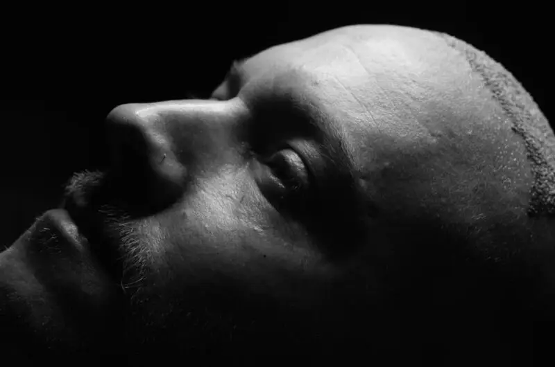 Side Effects After Hair Transplant: Why You Should Pick UniquEra Clinic