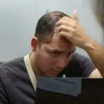 Signs of Hair Loss: How to Recognise It on Time and What Steps You Can Opt 2 Signs of Hair Loss