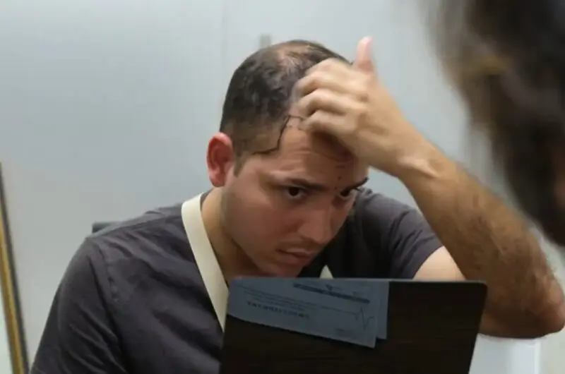 Signs of Hair Loss: How to Recognise It on Time and What Steps You Can Opt