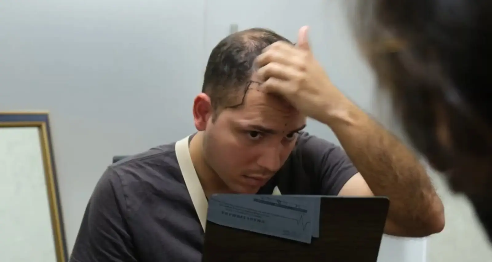 Signs of Hair Loss: How to Recognise It on Time and What Steps You Can Opt