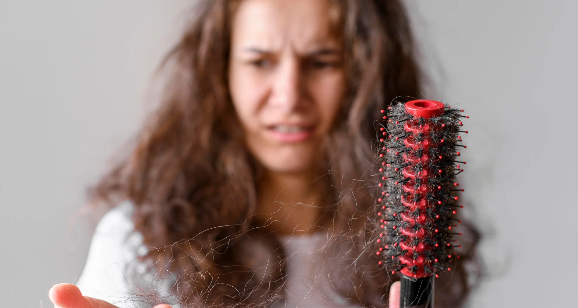 Anaemia Hair Loss: Signs, Symptoms, and Remedies