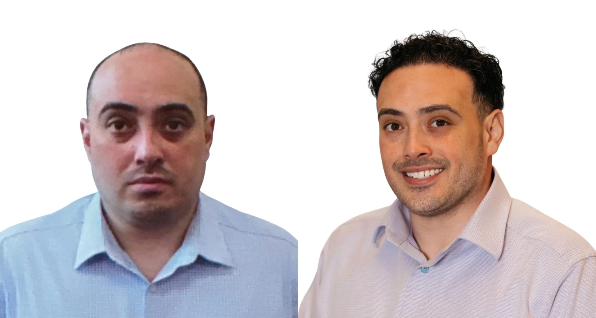 Do Hair Transplants Actually Work? Know the Effectiveness and Success Rates