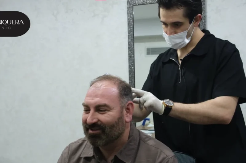 Sapphire FUE vs Traditional FUE: Which is Right for You?