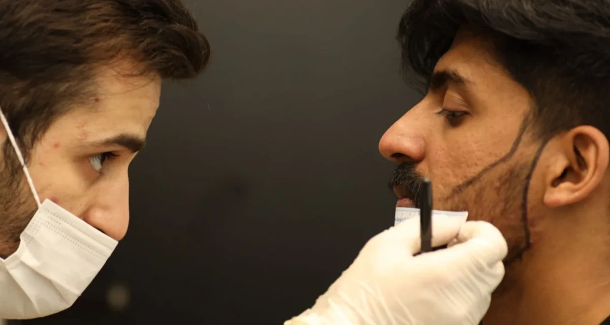 Beard Transplant in Turkey: Everything a Patient Needs to Know