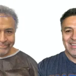 Do Hair Transplants Work_Uniquera_Clinic