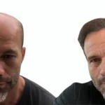 Is a 5000 Graft Hair Transplant Enough_uniquEra_clinic