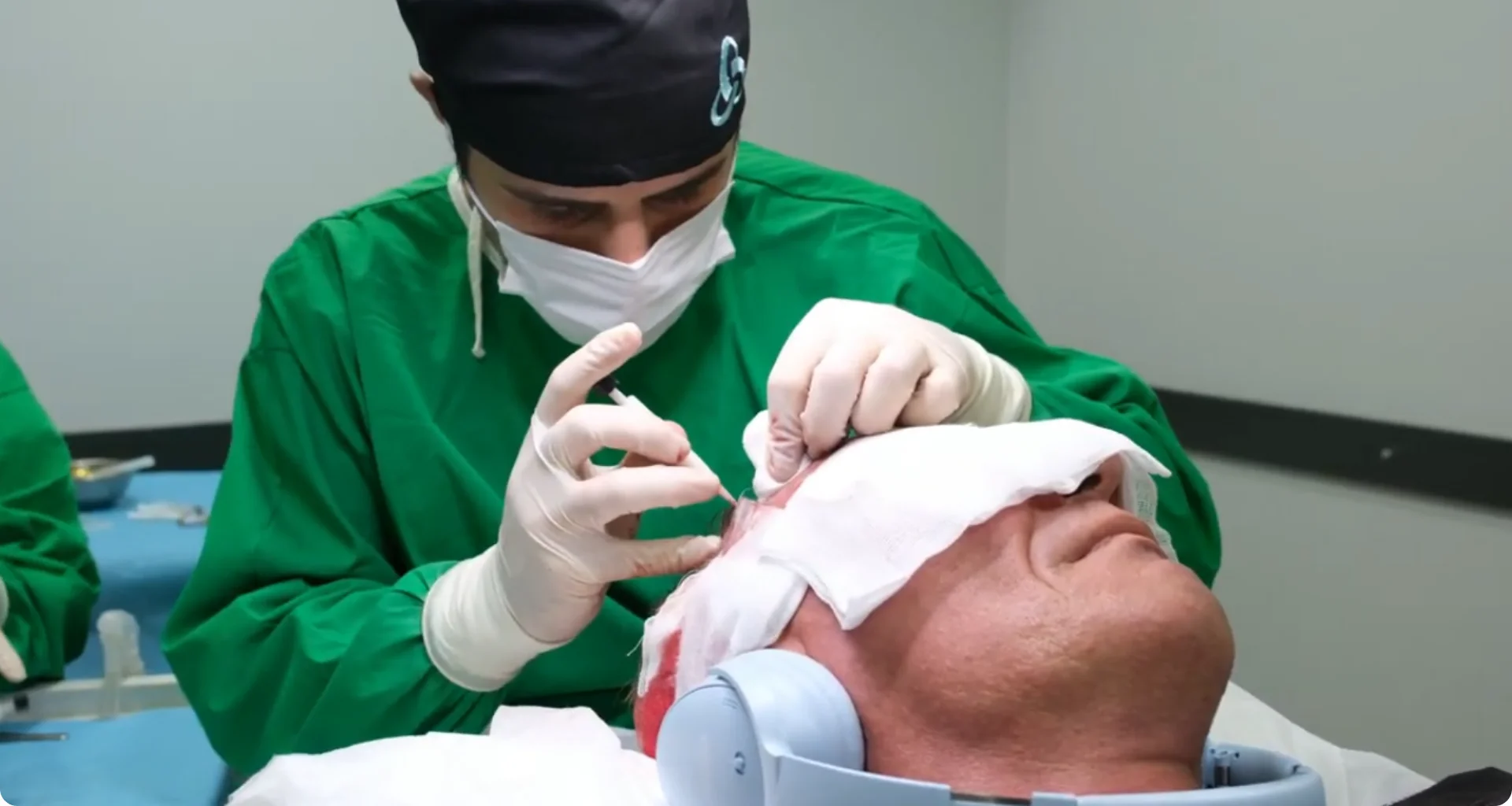 Step-by-Step Process of a DHI Hair Transplant in Turkey: A Complete Guide