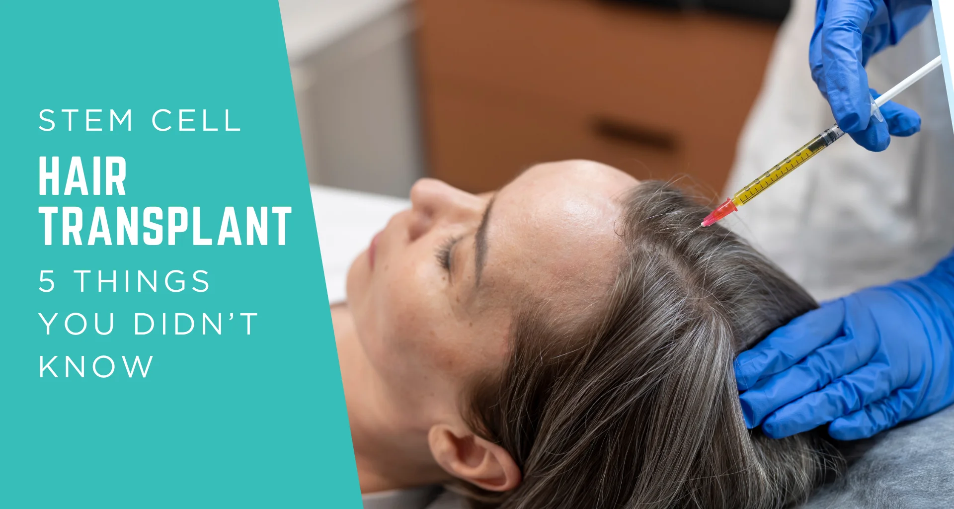 5 Things You Didn’t Know About Stem Cell Hair Transplant