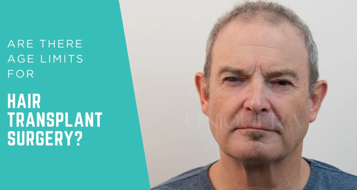 Are There Age Limits for Hair Transplants Surgery?