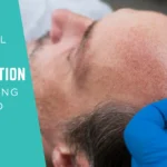 Stem Cell Hair Restoration