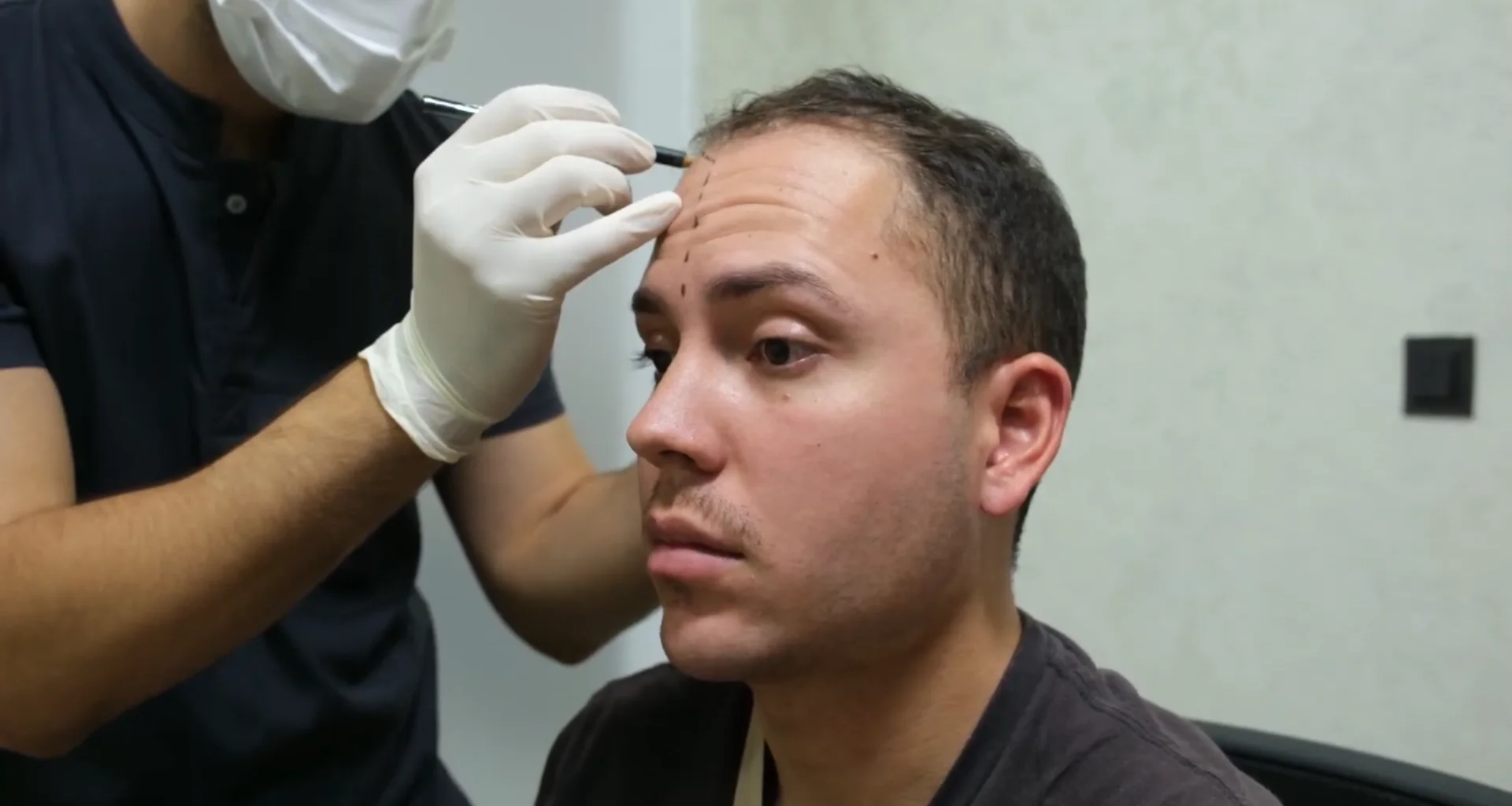 Top 10 Signs You May Need to Visit a Hair Loss Treatment Clinic in Turkey