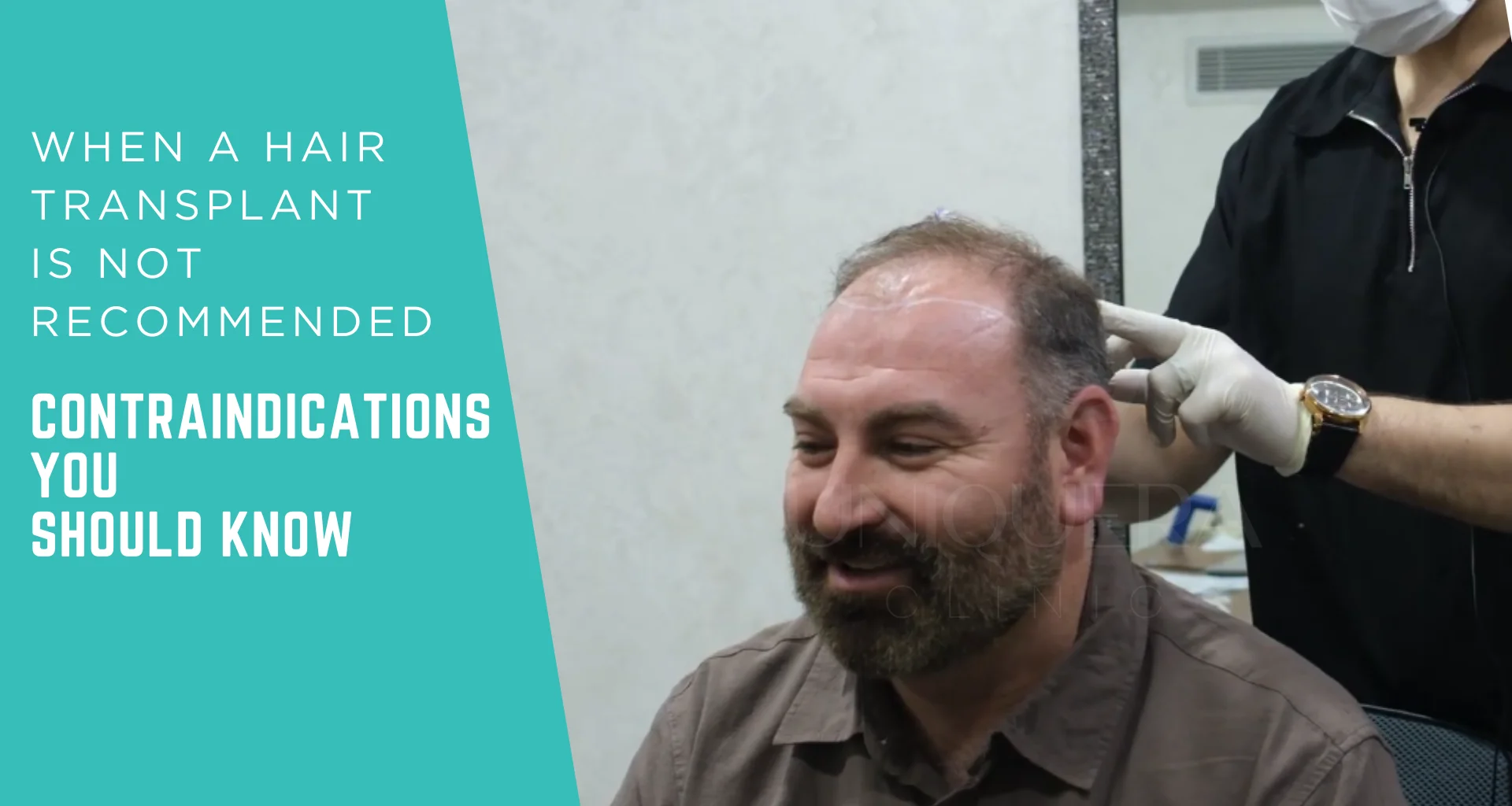 When a Hair Transplant Is Not Recommended: Contraindications You Should Know