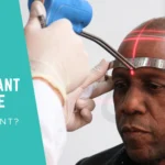 hair Transplant Technique