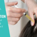 Stem cell hair restoration