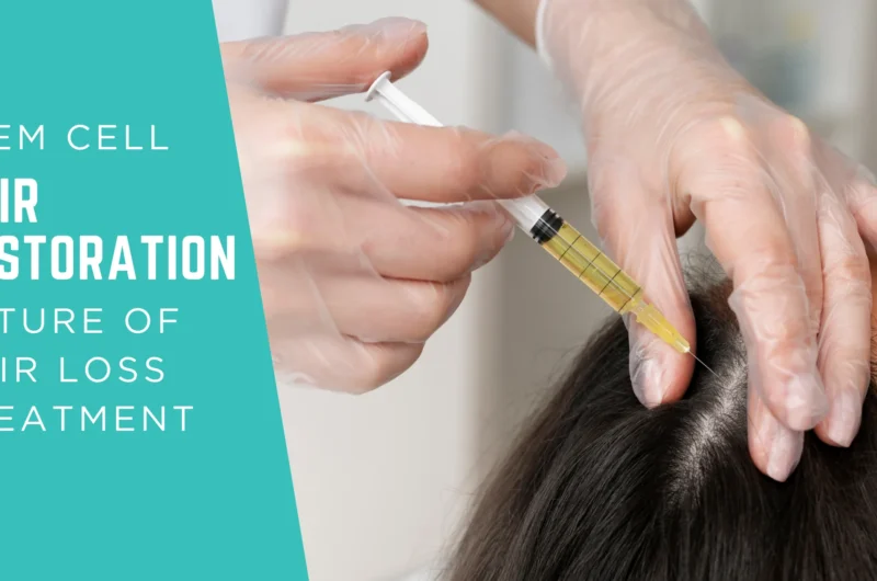 Why Stem Cell Hair Restoration Is the Future of Hair Loss Treatment