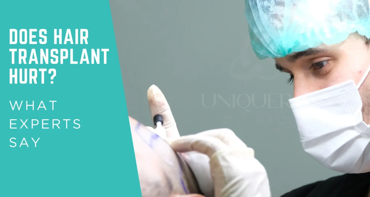Does Hair Transplant Hurt? What Experts Say