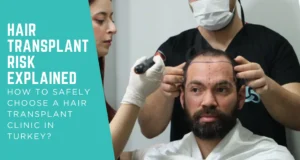 Home 65 Hair Transplant Risk