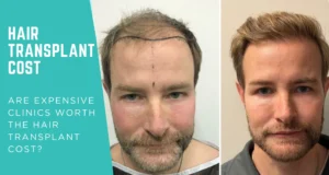 Hair Transplant Cost