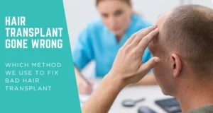 Hair Transplant Gone Wrong