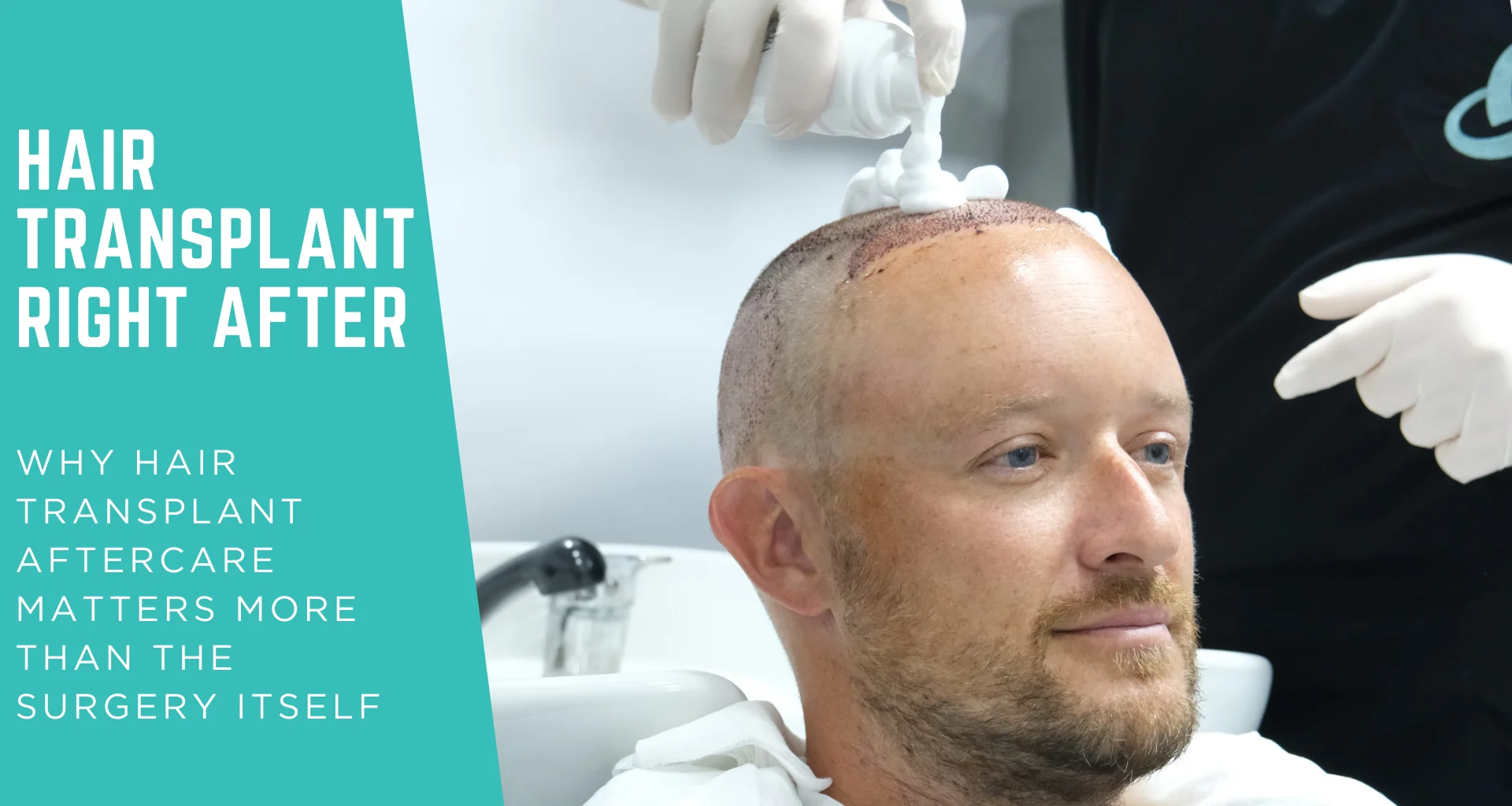 Hair Transplant Aftercare: Why Hair Transplant Aftercare Matters More Than the Surgery Itself