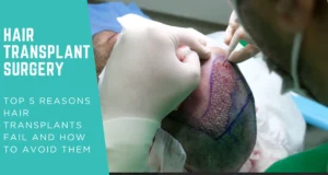 Top 5 Reasons Hair Transplants