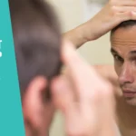 Cheap hair transplant