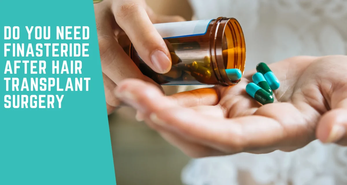 Do You Need Finasteride After Hair Transplant Surgery?
