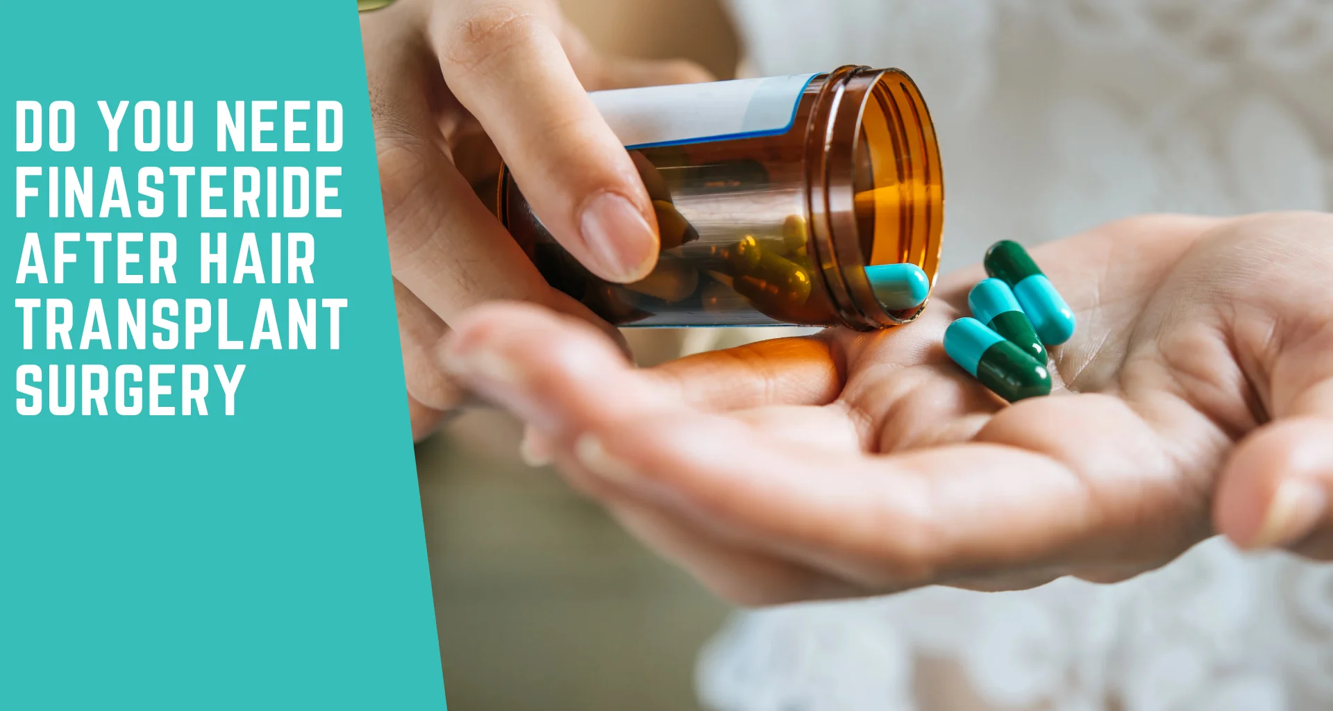 Do You Need Finasteride After Hair Transplant Surgery?