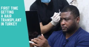 First Time Getting a Hair Transplant in Turkey