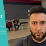 Norwood 5 hair transplant