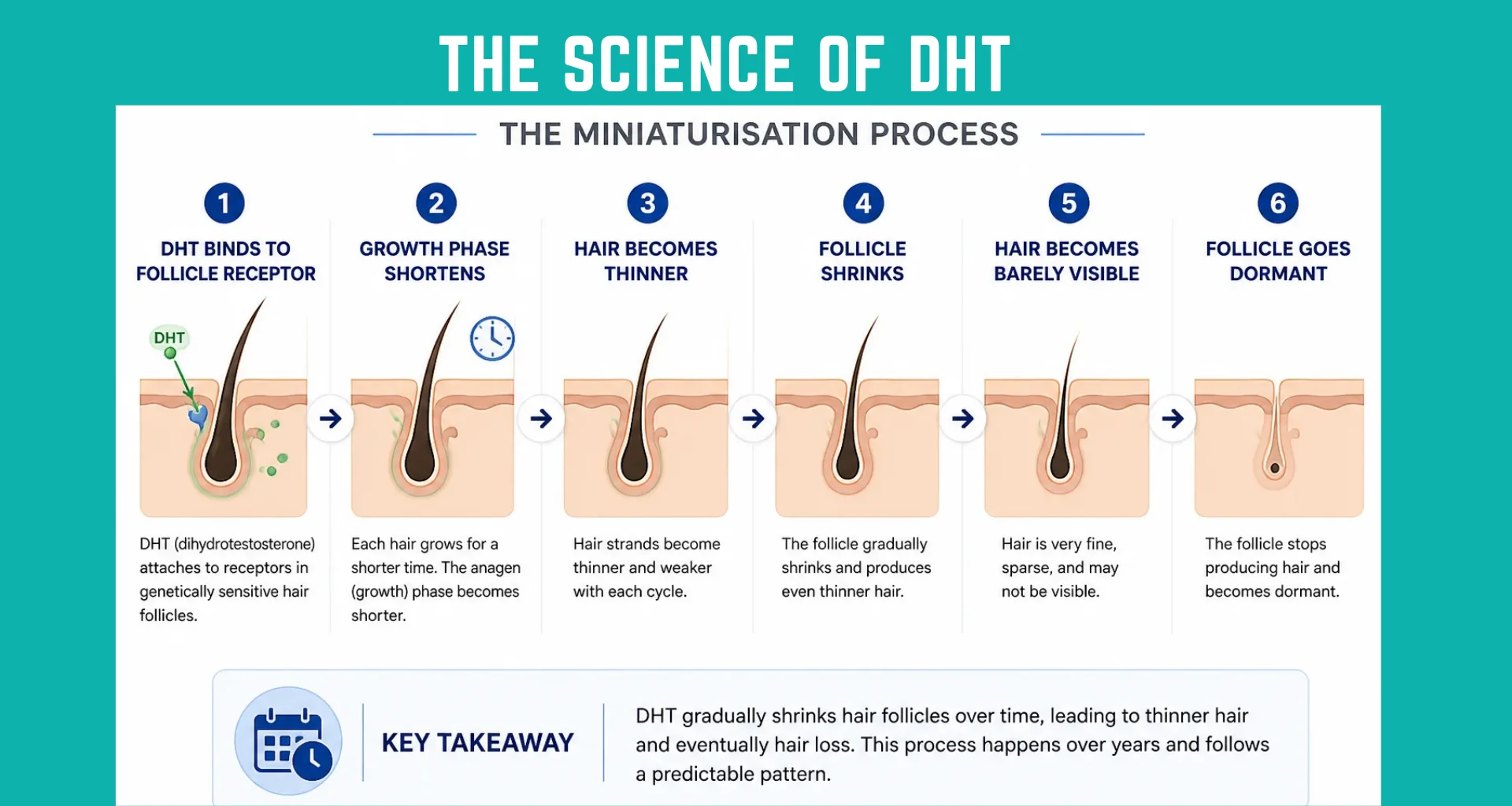 Science Behind DHT hair loss : Why It Shrinks Hair Follicles