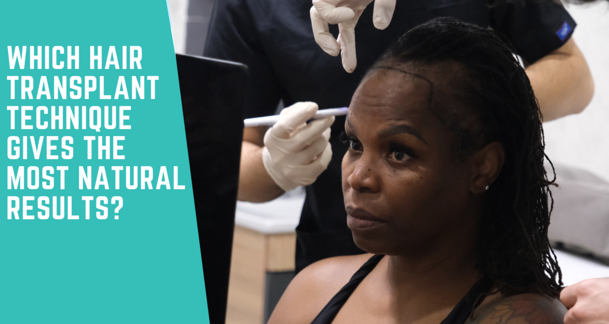 Which Hair Transplant Technique Gives the Most Natural Results?