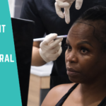 Hair Transplant Technique