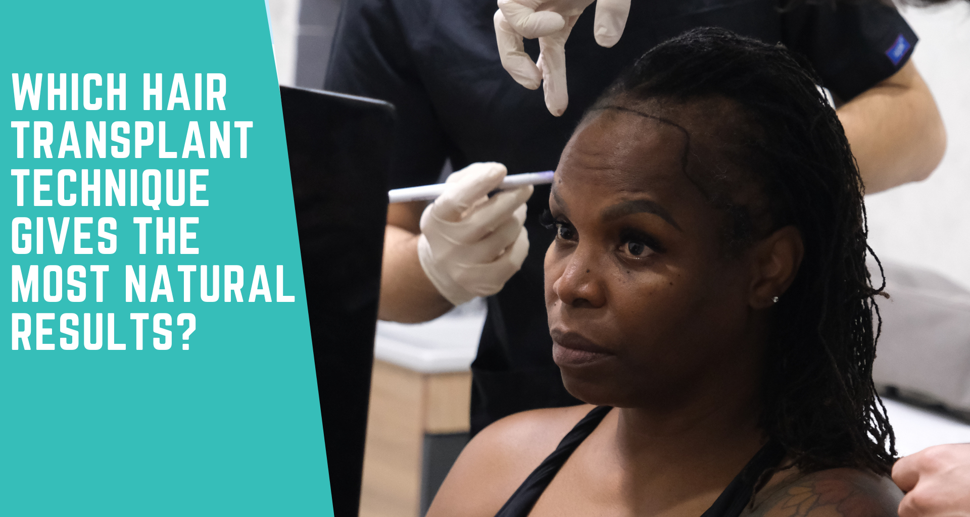 Which Hair Transplant Technique Gives the Most Natural Results?