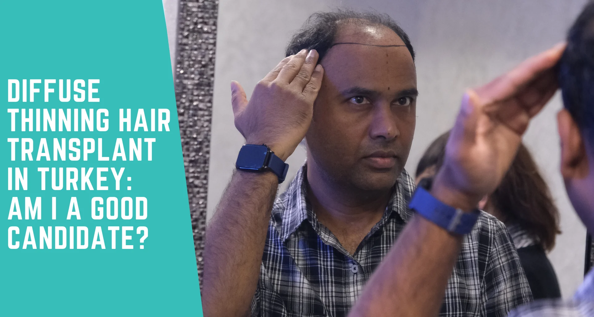 Diffuse Thinning Hair Transplant in Turkey: Am I a Good Candidate?
