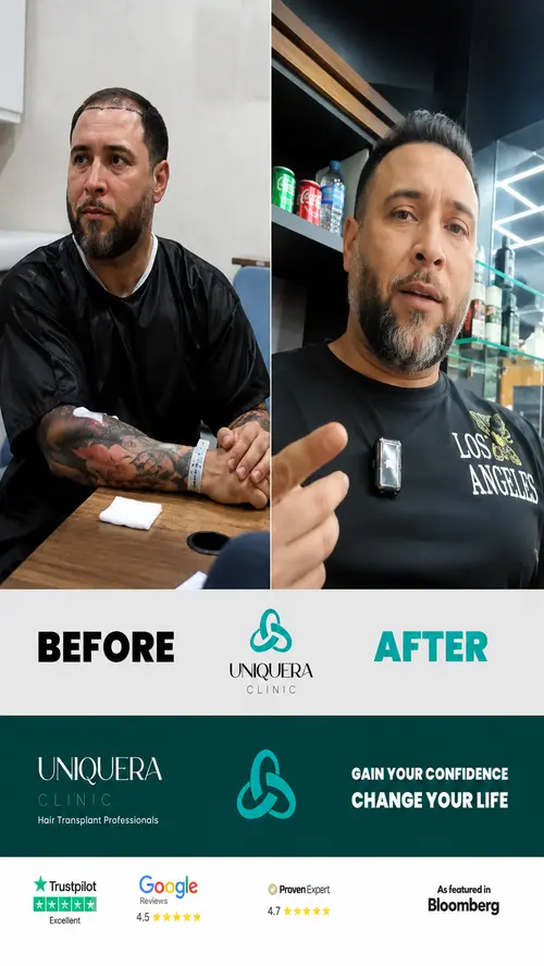 Testimonials 39 before after 500w q75